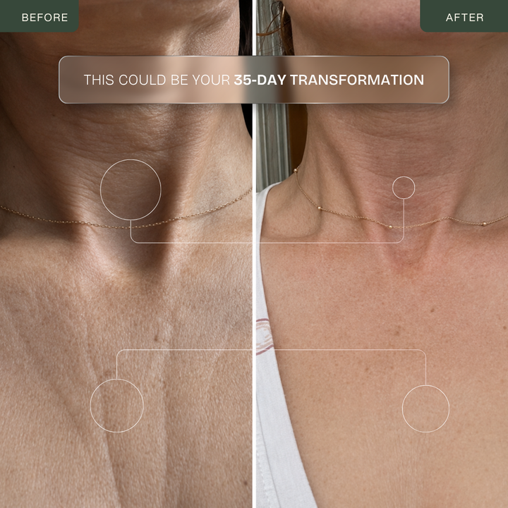 Pro LED Neck & Décolleté Mask — 850nm Near-Infrared Therapy