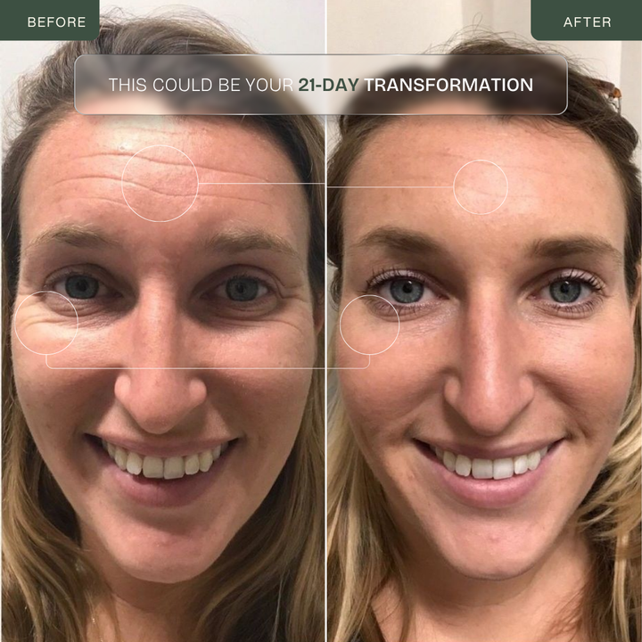 Pro PDT LED Lamp — Photodynamic Therapy for Face & Body