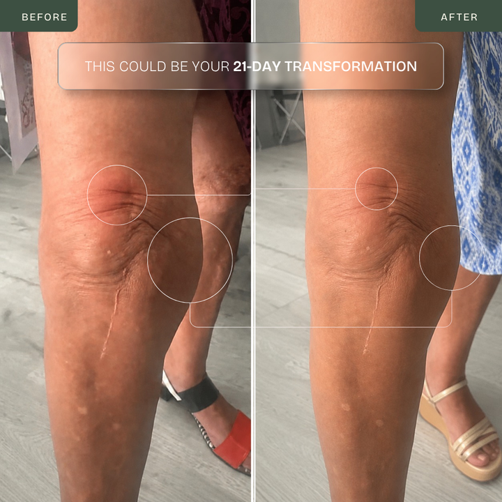 Cordless Knee Massager — Infrared, Heat, Vibration & Laser Therapy