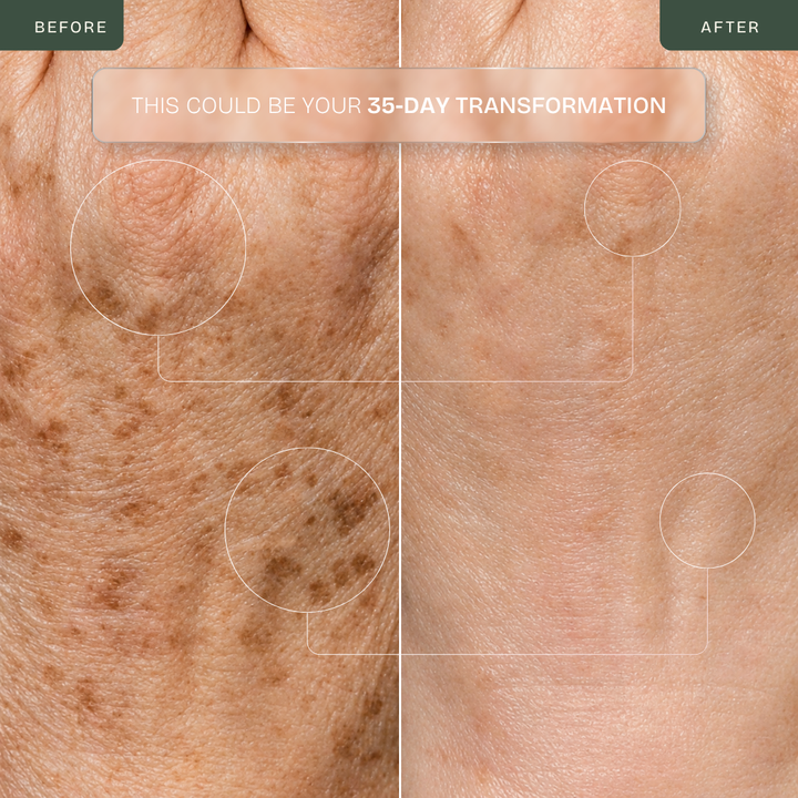 Hand Glow Pro — Triple-Wavelength LED Hand Rejuvenation