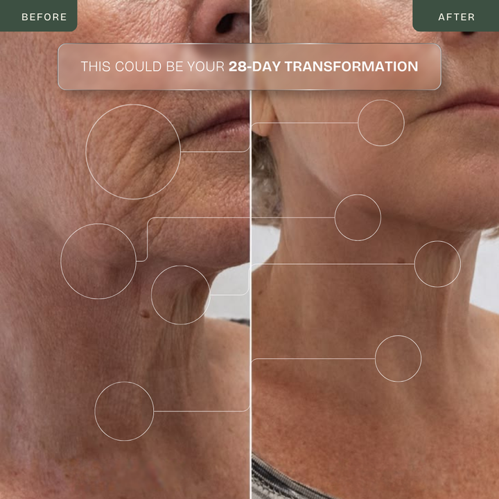 24K Gold RF Lifting Wand — Face & Neck Sculptor