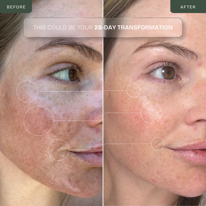 Pro LED Face Mask — 850nm Near-Infrared & Red Light Therapy