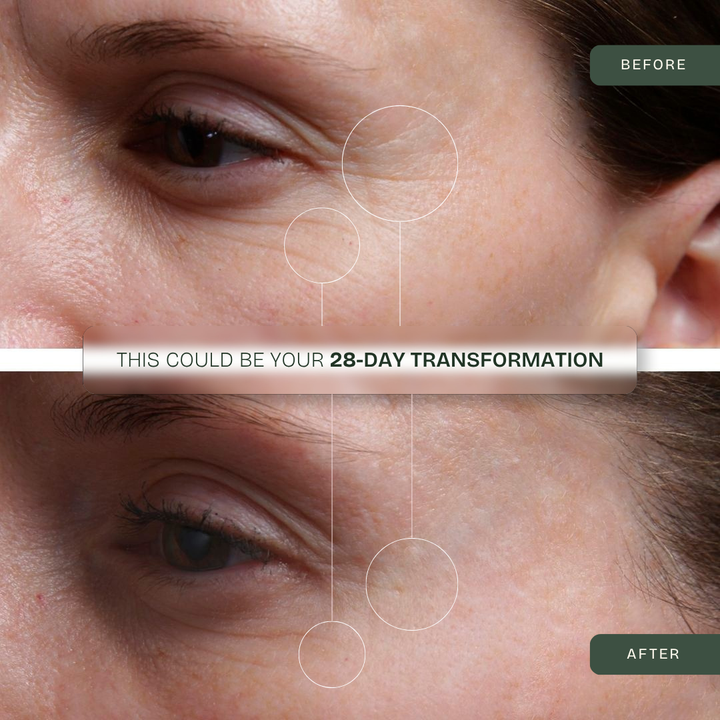 Eye Glow Mask — 850nm Triple-Spectrum LED Eye Therapy